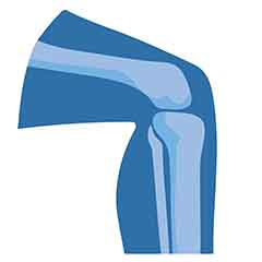 Saúde da articulação e do osso