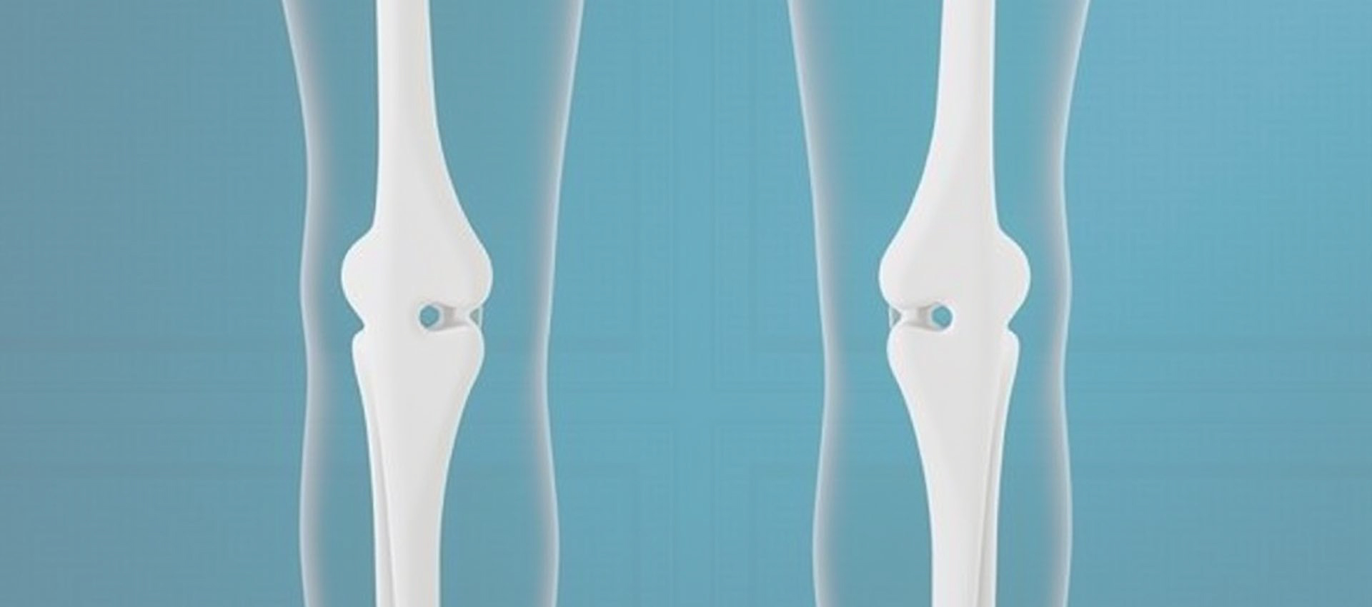 Vitamina Lipossomal D3