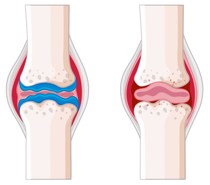 Promove a saúde óssea e cardiovascular